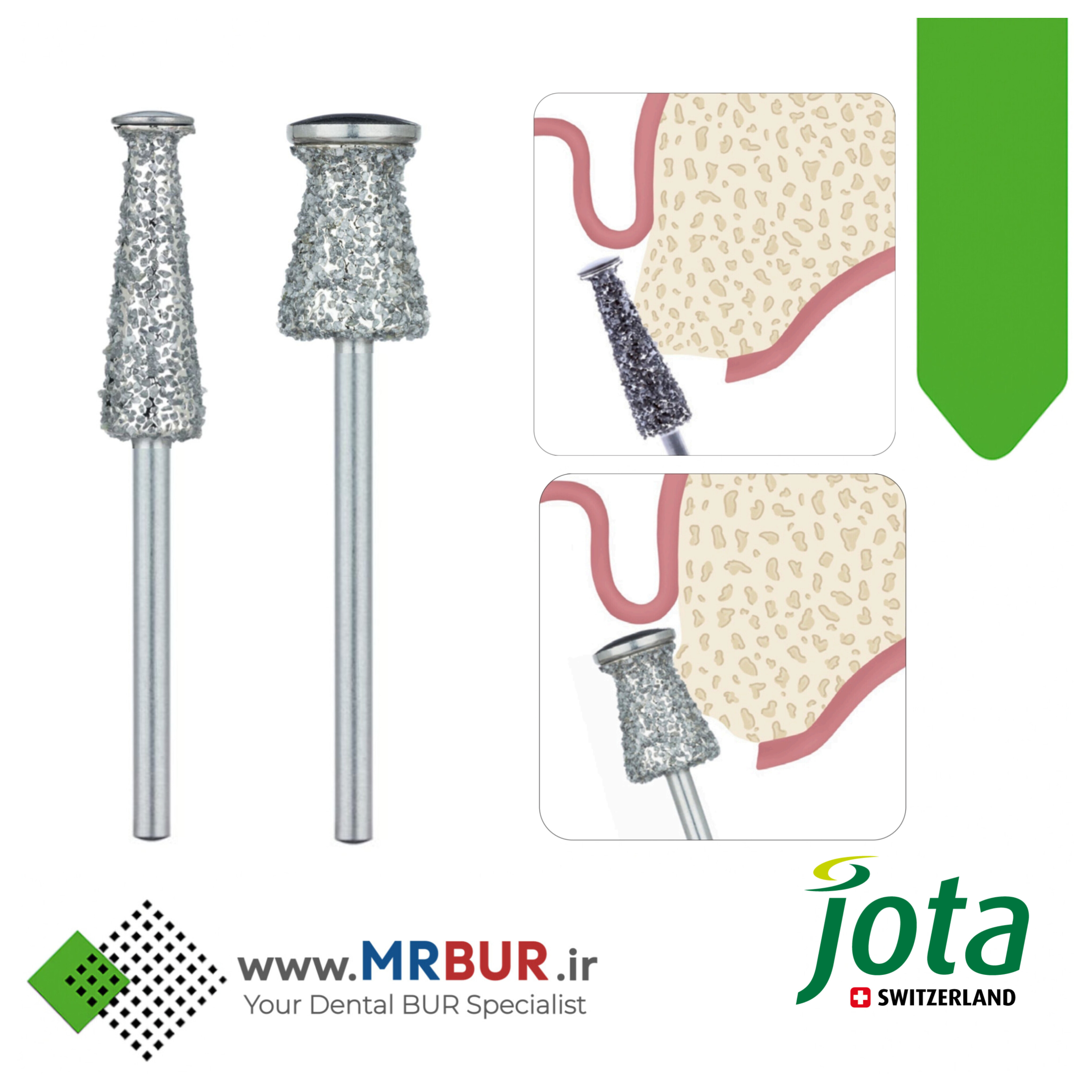 فرز دندانپزشکی الماسی جراحی آلو‌ئوپلاستی برای کانتورینگ ریج جوتا JOTA کد D8307XG