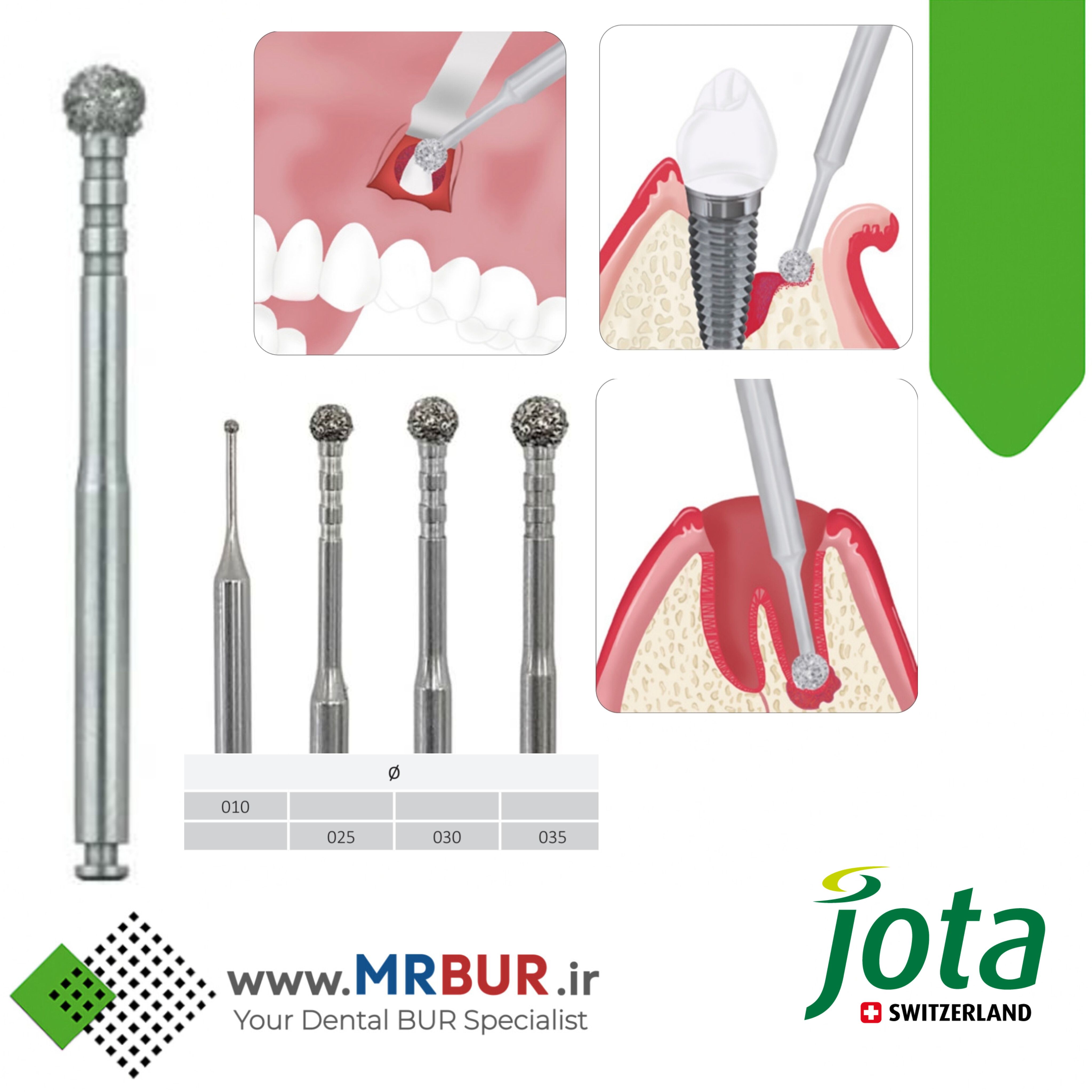 فرز دندانپزشکی الماسی جراحی گرانولاسیون مخصوص آنگل جوتا JOTA کد 801LD